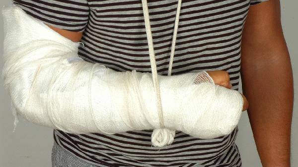 尺骨鹰嘴骨折后的护理措施有哪些