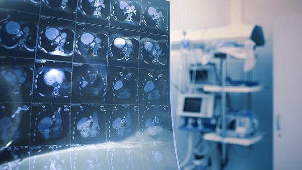 铺路石样变性怎么样进行诊断