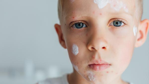 半边脸发麻是怎么回事 半边脸发麻与这些原因有关系