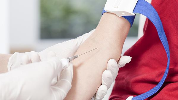 被泰迪咬破皮了不打针没事吗