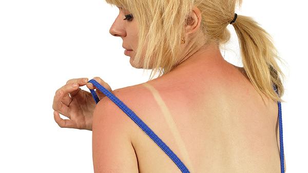 右手手背一根筋感觉疼怎么办