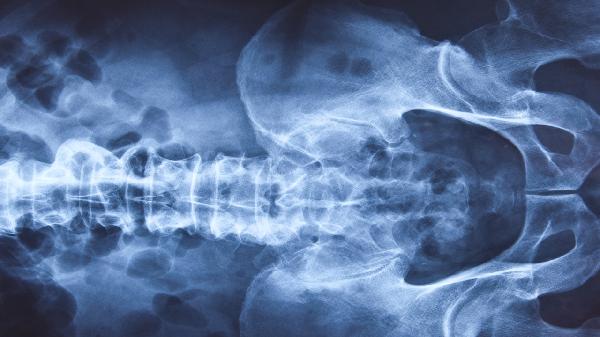 CT检查前的注意事项有哪些