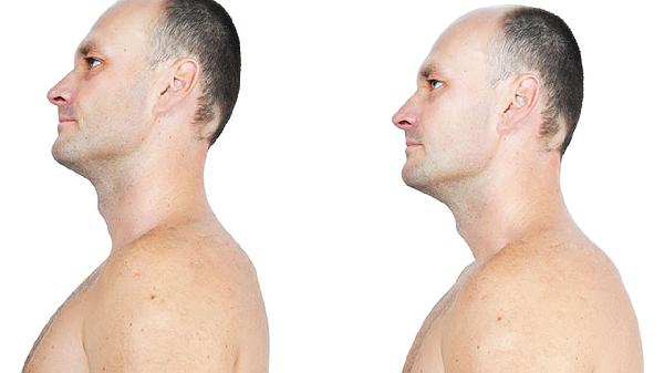 肩膀疼痛是什么原因引起的