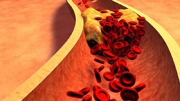 经常有这4个习惯的人,易被癌症“盯上”,若你没有,值得高兴