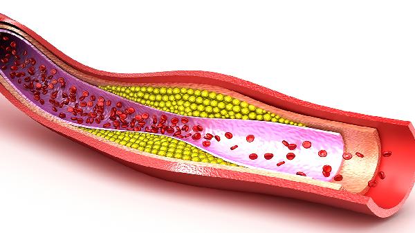 若出现这3个症状,警惕血液已黏稠如粥,劝你及时抽血检查