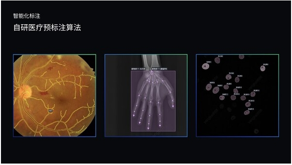 澳鹏发布MediGo医疗大模型数据开发平台 破解医疗AI数据瓶颈