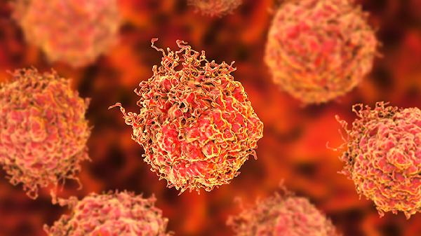 癌症患者吃什么菜最好抗癌