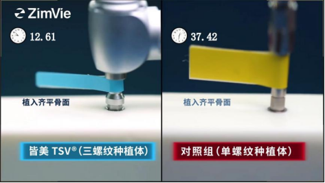三螺纹种植体为何能快3倍?揭秘进口种植体的 “速度与舒适” 真相