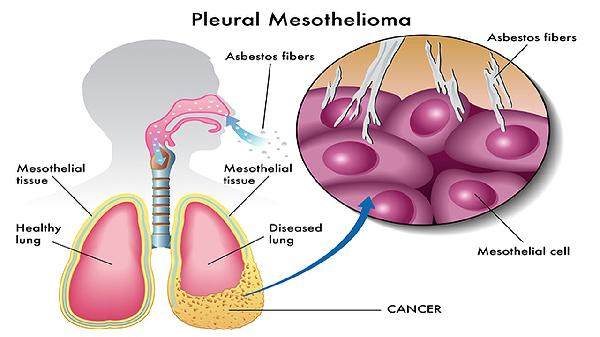 B肝实质回声欠均匀是什么意思