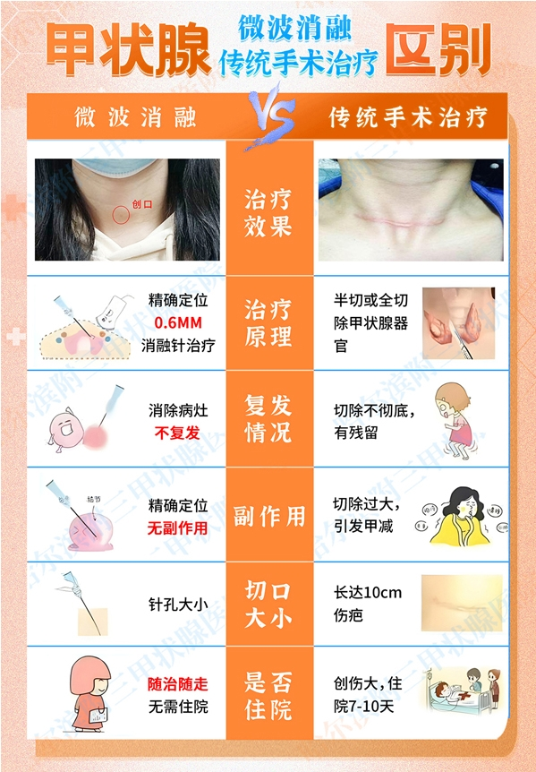 哈尔滨附三甲状腺医院微波消融术对比开刀的利弊分析