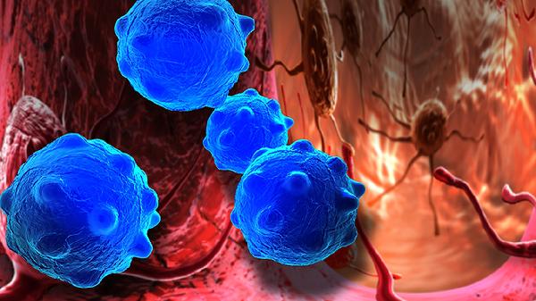 嗜酸性粒细胞百分比偏高是怎么回事