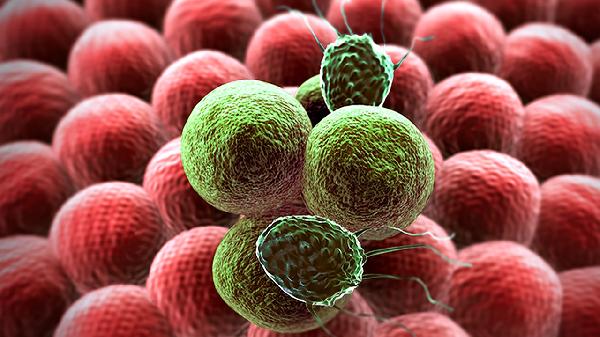 巨幼细胞性贫血是怎么回事 2原因会产生巨幼细胞性贫血