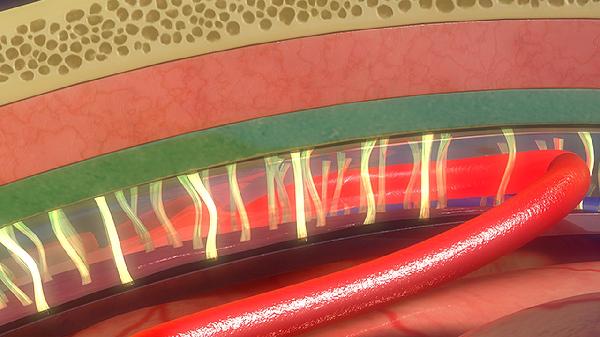 血管性痴呆和老年痴呆相同吗 区别两种类型痴呆症