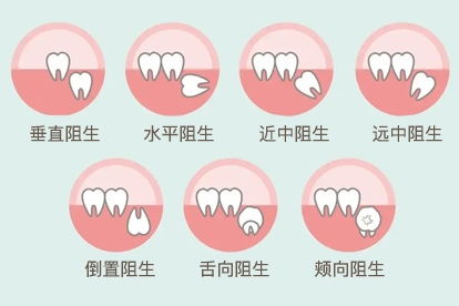 智齿长歪了碰到旁边的牙了