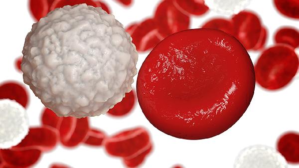 怎么治疗肝母细胞瘤 联合四个方法治肝母细胞瘤