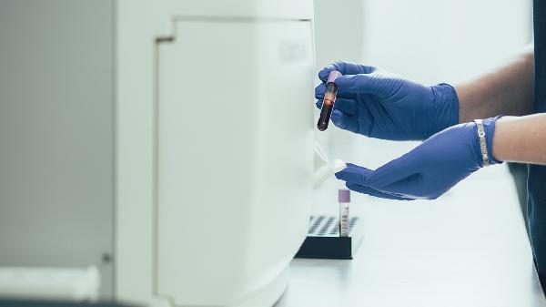 淋巴瘤血常规检查方法是什么