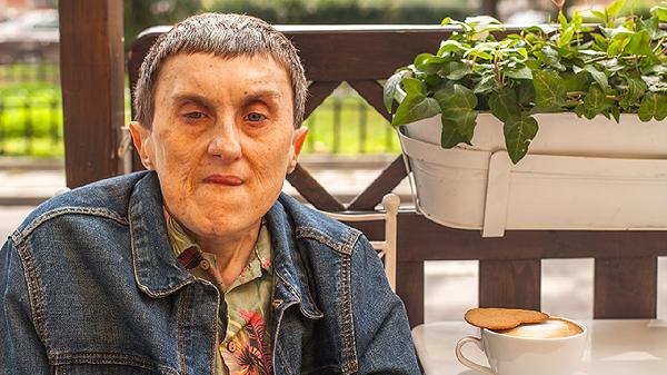 脸上的痣越长越多怎么回事