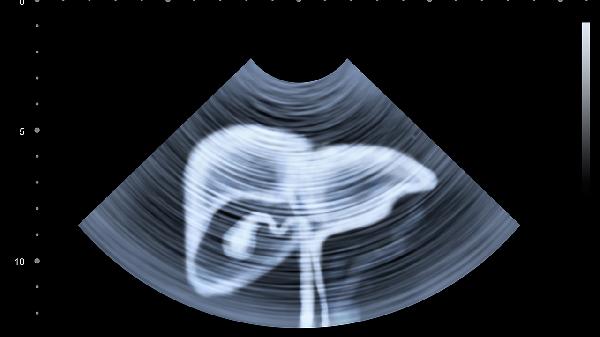 女性腹部左下方一动疼痛是什么原因