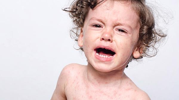 平时不痛不痒，体检却查出代谢综合症？坦言：这种病，真的别忽视