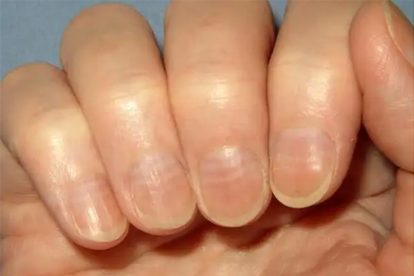 睡觉时,频繁出现手脚麻的现象,或是身体发出的讯号,应引起重视