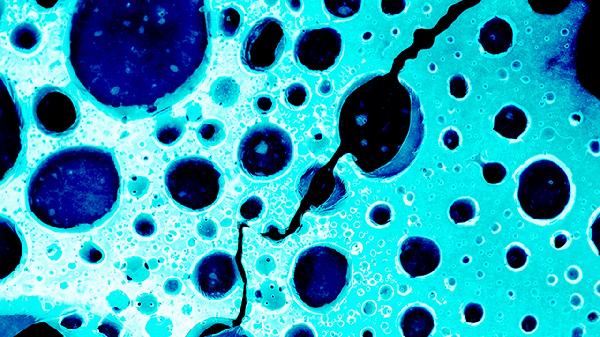 癌症患者能运动吗？各个阶段的自我锻炼方法不一，千万别做错了