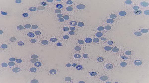 皮肤出现这种“痒”,挠痒也止不住?可能是恶性肿瘤信号,别忽视