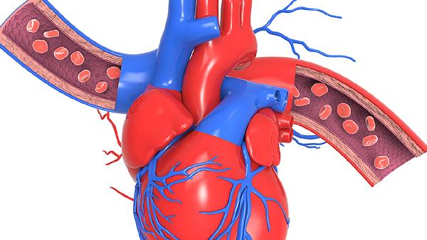人造血管带膜支架植入术后应注意什么