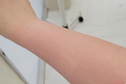 手腕上有个凸起的骨头怎么回事