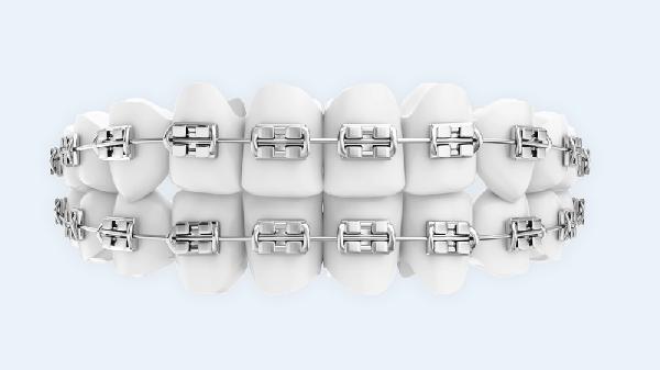 成年人与未成年人牙齿矫正手术有什么区别