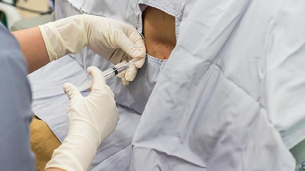 被猫抓了一下轻微破皮要打针吗