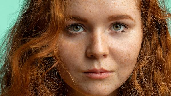 为什么中年妇女更加容易患上黄褐斑