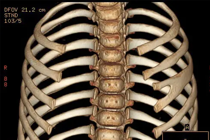 肋骨两边下面隐隐作痛怎么回事
