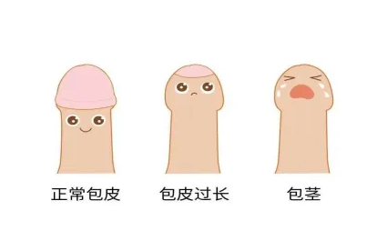 一岁的宝宝生殖器包茎怎么办