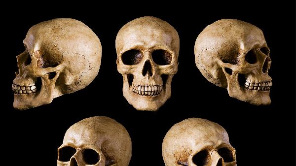 儿童颅骨修补要注意哪些问题