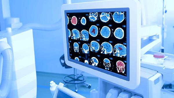 依赖综合征诊断标准中的症状标准有什么