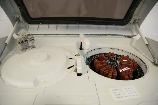 血栓性血小板减少性紫癜的实验室检查