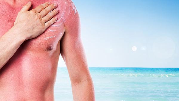 海边晒伤刺痛睡不着觉怎么回事，怎么办