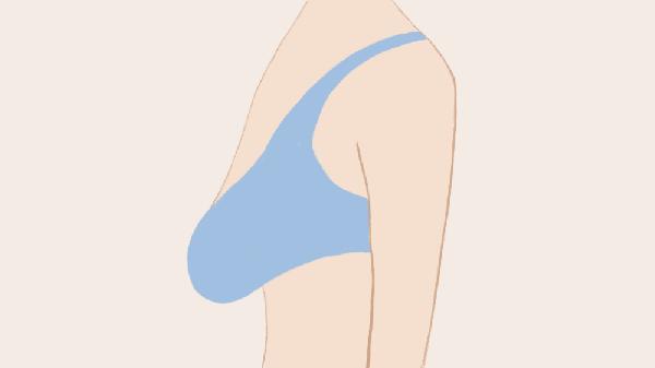 生完孩子胸部下垂怎么办 四种小妙招使胸部重新坚挺起来