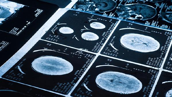 细胞角19片段轻微高是多少