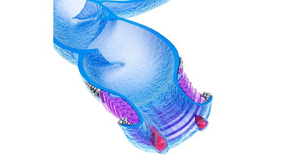 嗜铬细胞瘤特征性表现有哪些