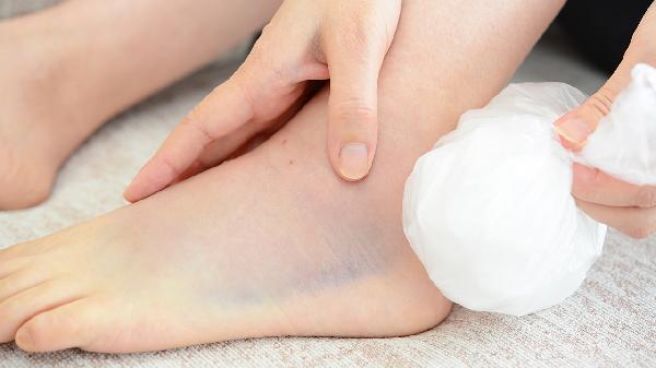 退熱貼可以代替冰敷消腫嗎