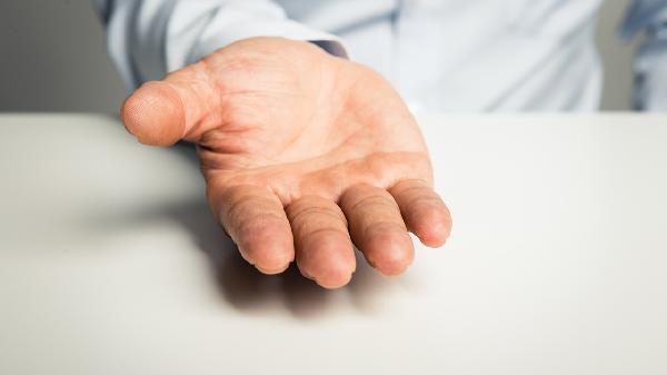 小手指挫伤，最后一节不能伸直