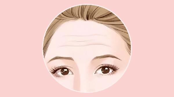 祛除抬头纹可以打玻尿酸吗 如何快速去除抬头纹