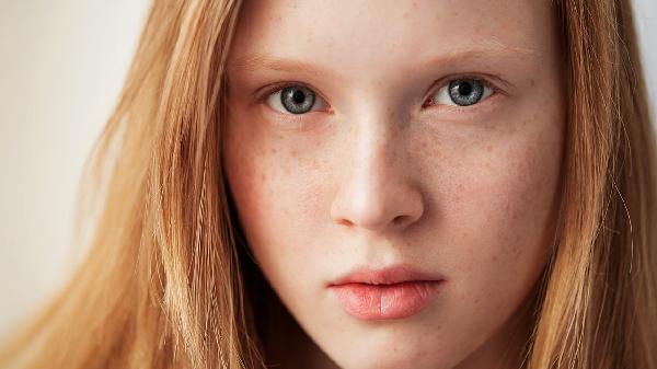 女人趴着午睡易长斑点吗 这几种行为会导致女性长斑