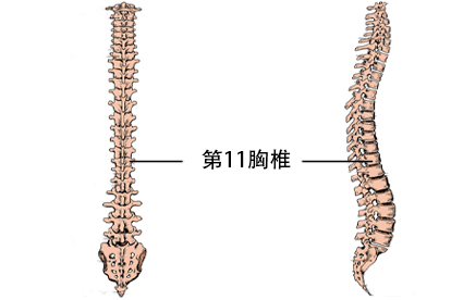 第十一胸椎压缩性骨折最好的治疗方法