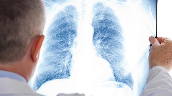 晚上胸闷气短呼吸困难,白天没事怎么回事