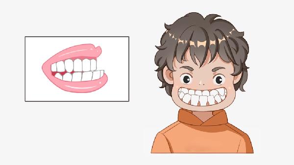 地包天多大可以看出来 了解地包天的常见症状特征