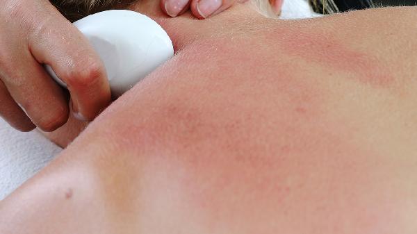 背部经常刮痧会引发白癜风吗