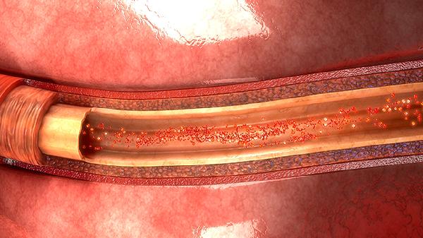 淋巴细胞绝对数偏低如何治疗