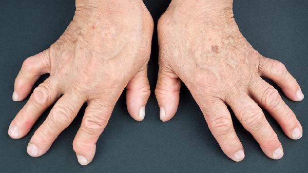 颞颌性关节炎是怎么引起的